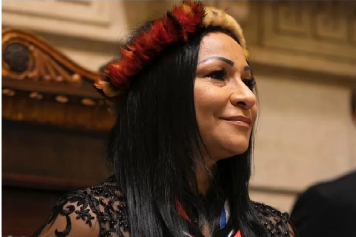 Deputada federal eleita no Amapá é acusada de pagar harmonização facial com dinheiro de campanha