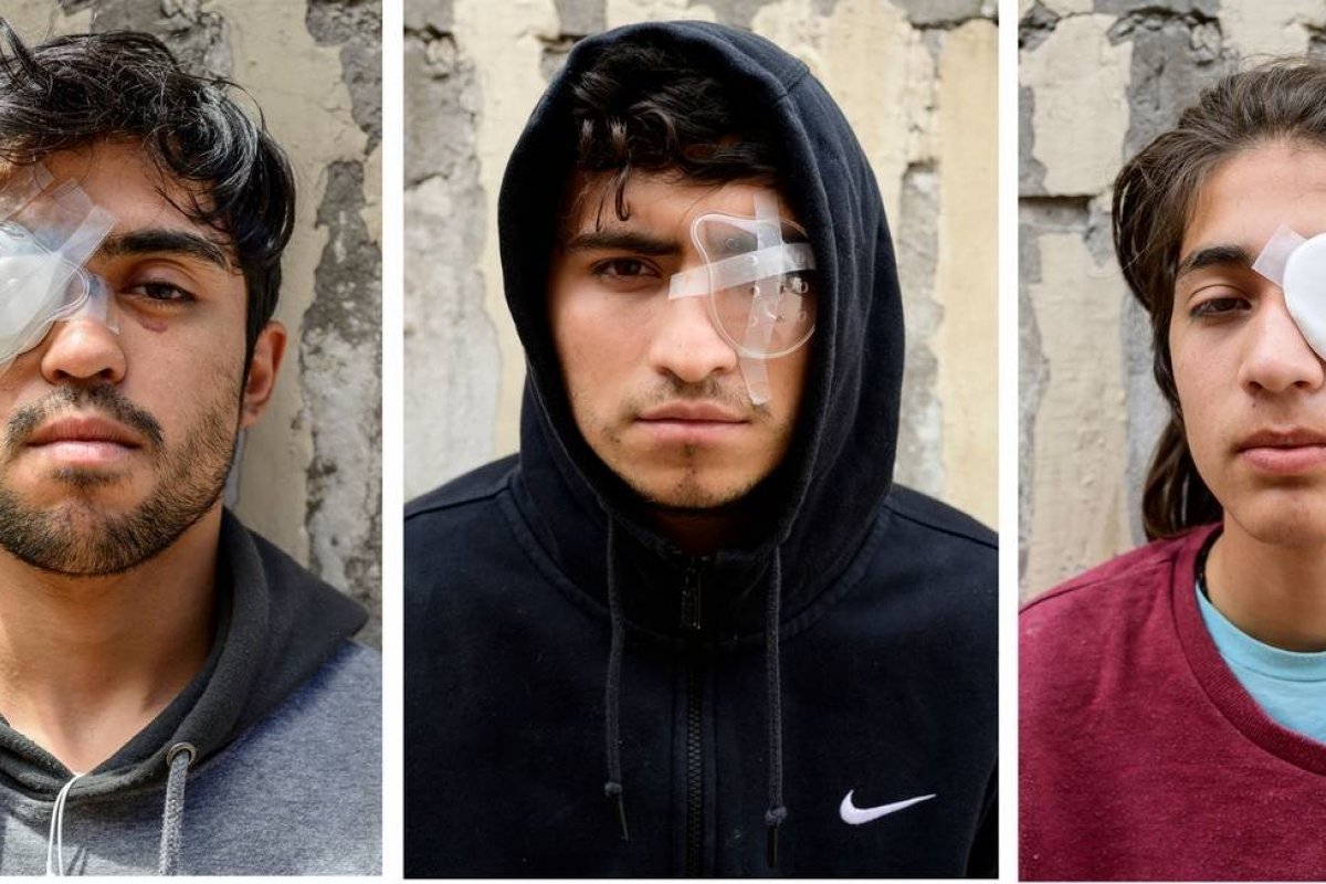 Mais de 200 pessoas perderam visão em decorrência de protestos no Chile