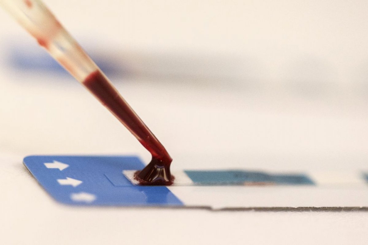 Pesquisadores testam novo tratamento para combater o vírus do HIV