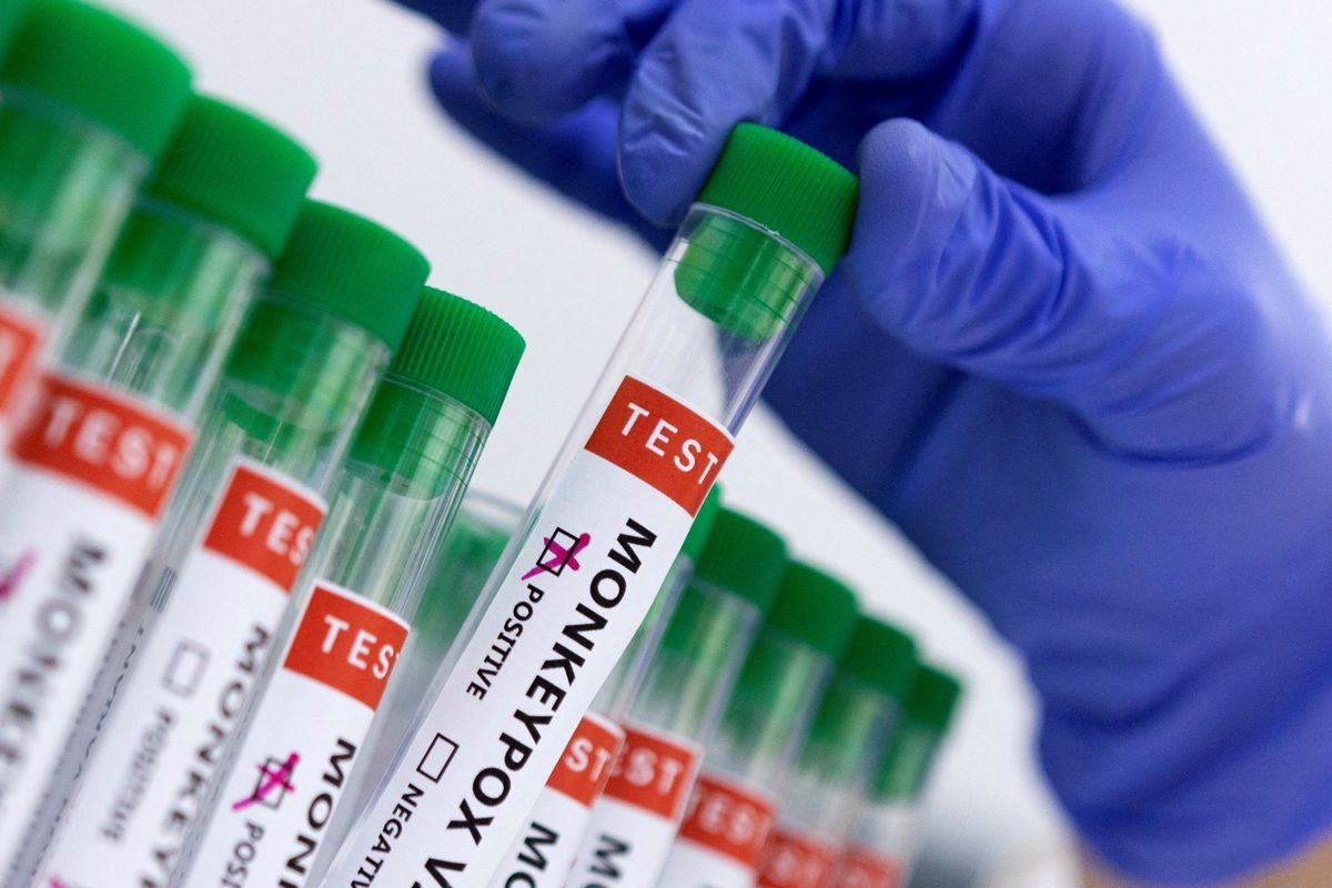 Fiocruz lança pesquisa para avaliar conhecimento sobre varíola dos macacos