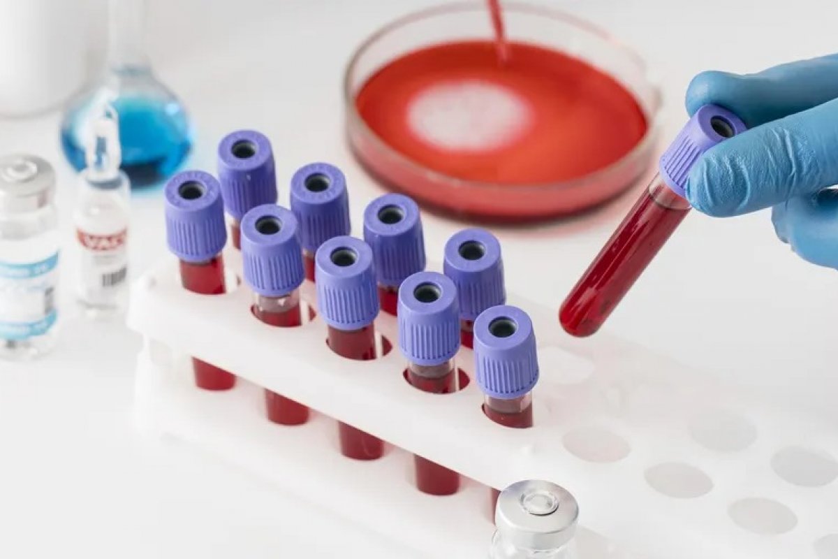 Exames de sangue podem sinalizar transtornos mentais, diz estudo