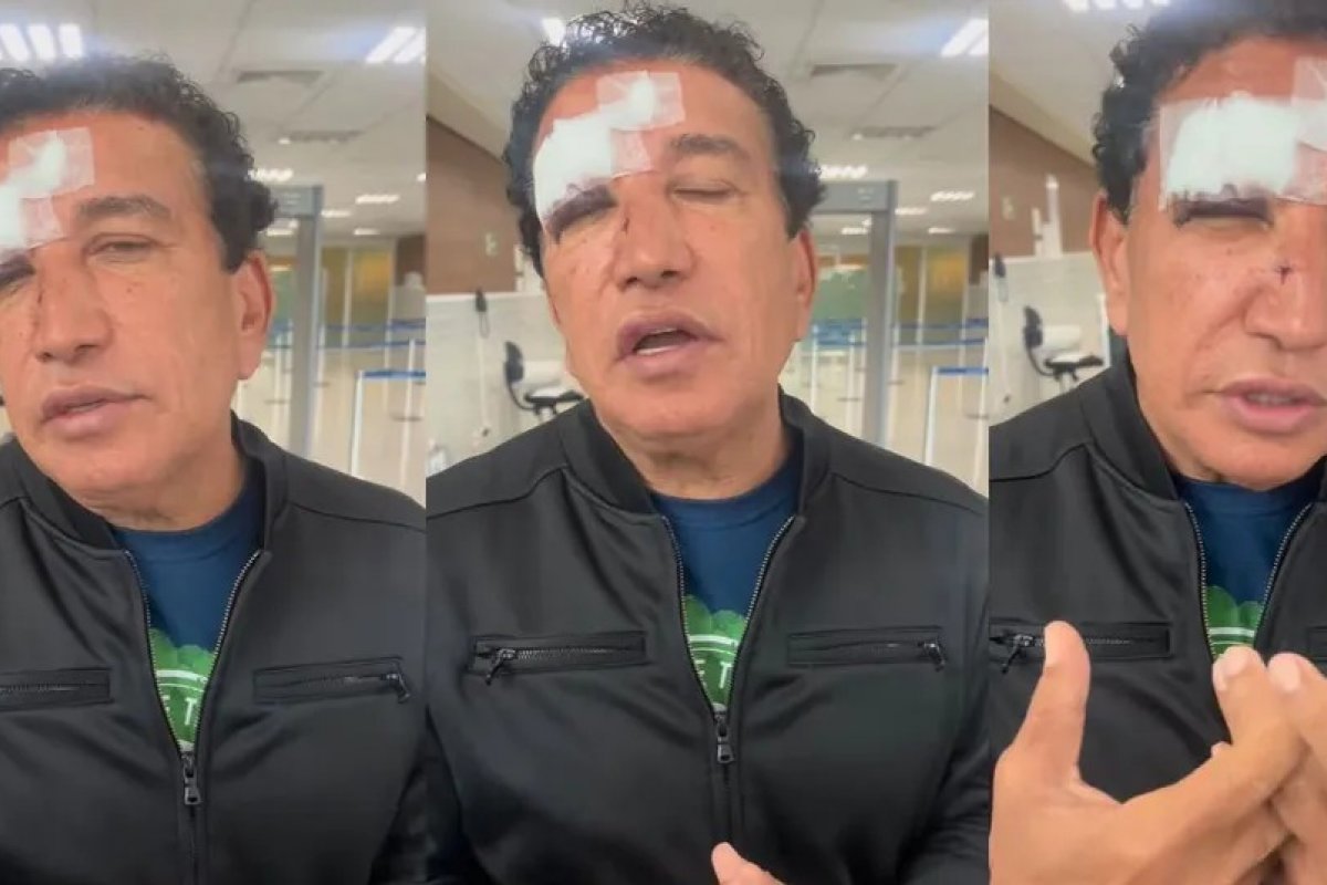 Magno Malta é hospitalizado com ferimentos no rosto após vidro de banheiro de hotel quebrar