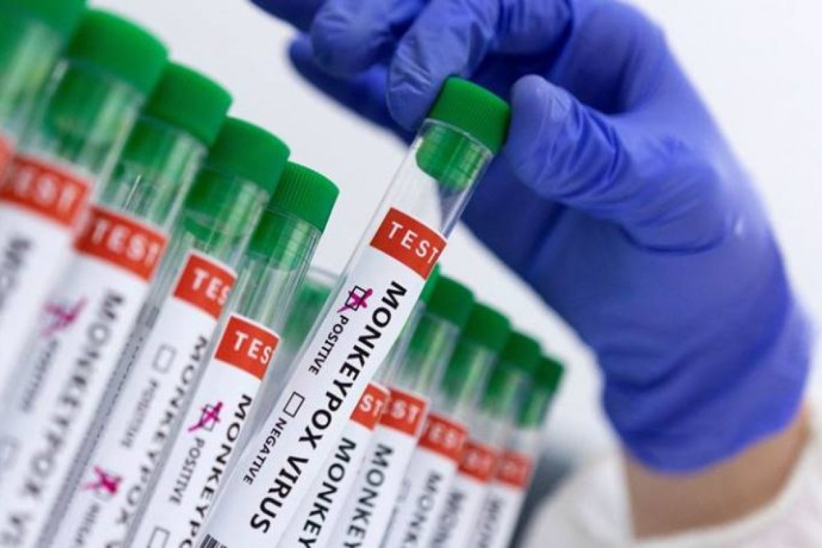 Brasil registra oito óbitos pela Varíola dos Macacos