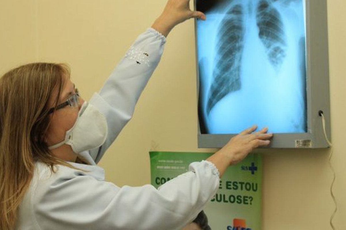 Casos de tuberculose voltam a crescer no mundo, afirma OMS
