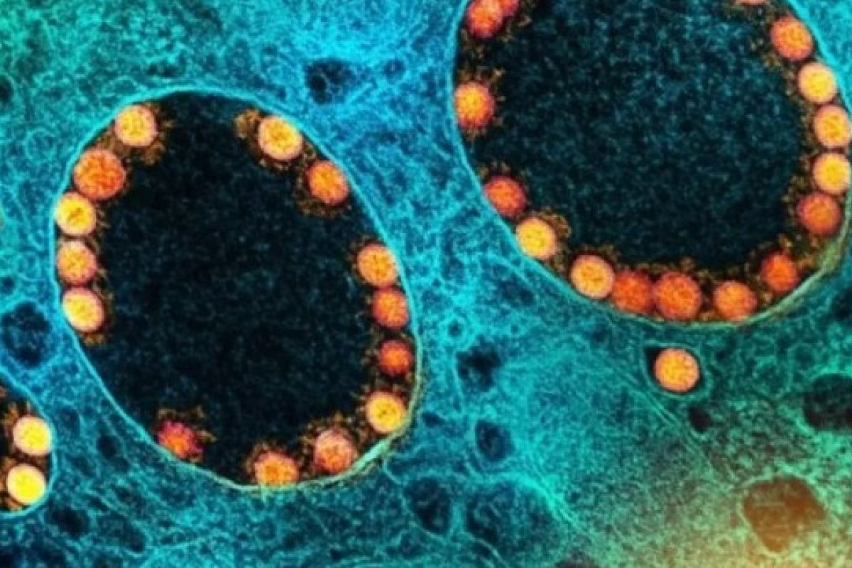Nova subvariante da Ômicron pode causar onda de Covid no Brasil, alerta especialista
