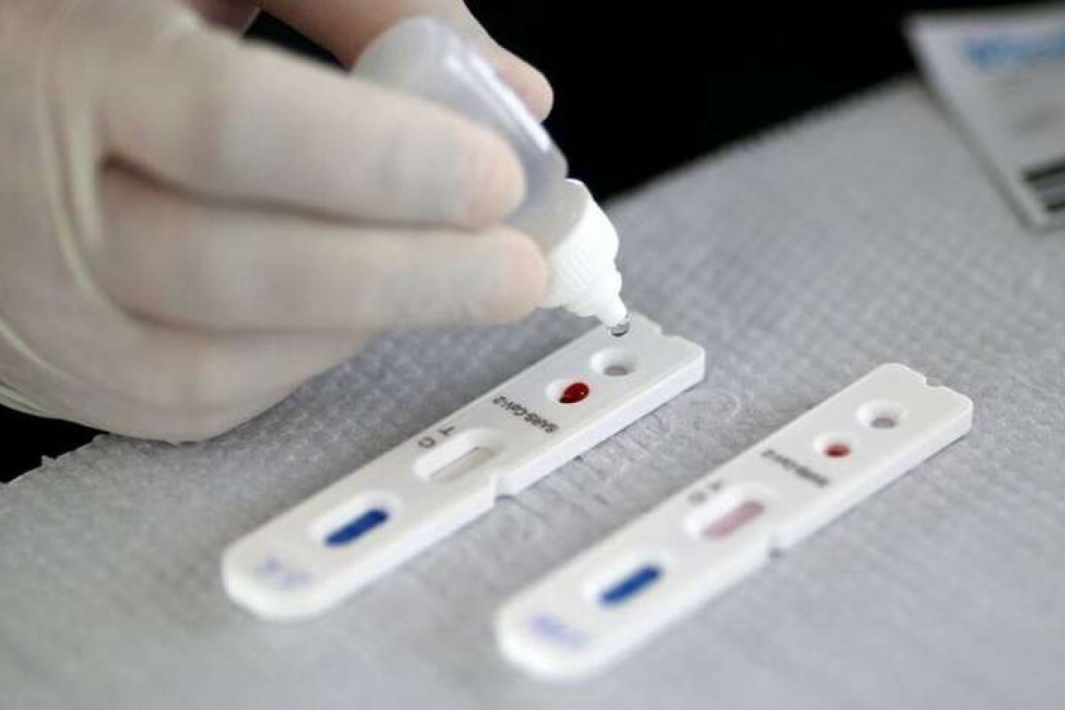 Testes positivos de Covid-18 em farmácias voltam a superar 20%, diz Abrafarma