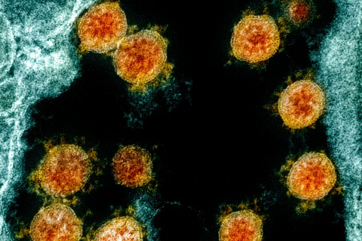 Instituto Butantan encontra sublinhagens da Covid-19 em São Paulo e em Ribeirão Preto