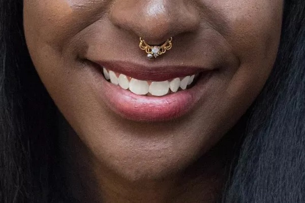 Mulheres negras são as que mais sofrem com a perda dentária, aponta estudo