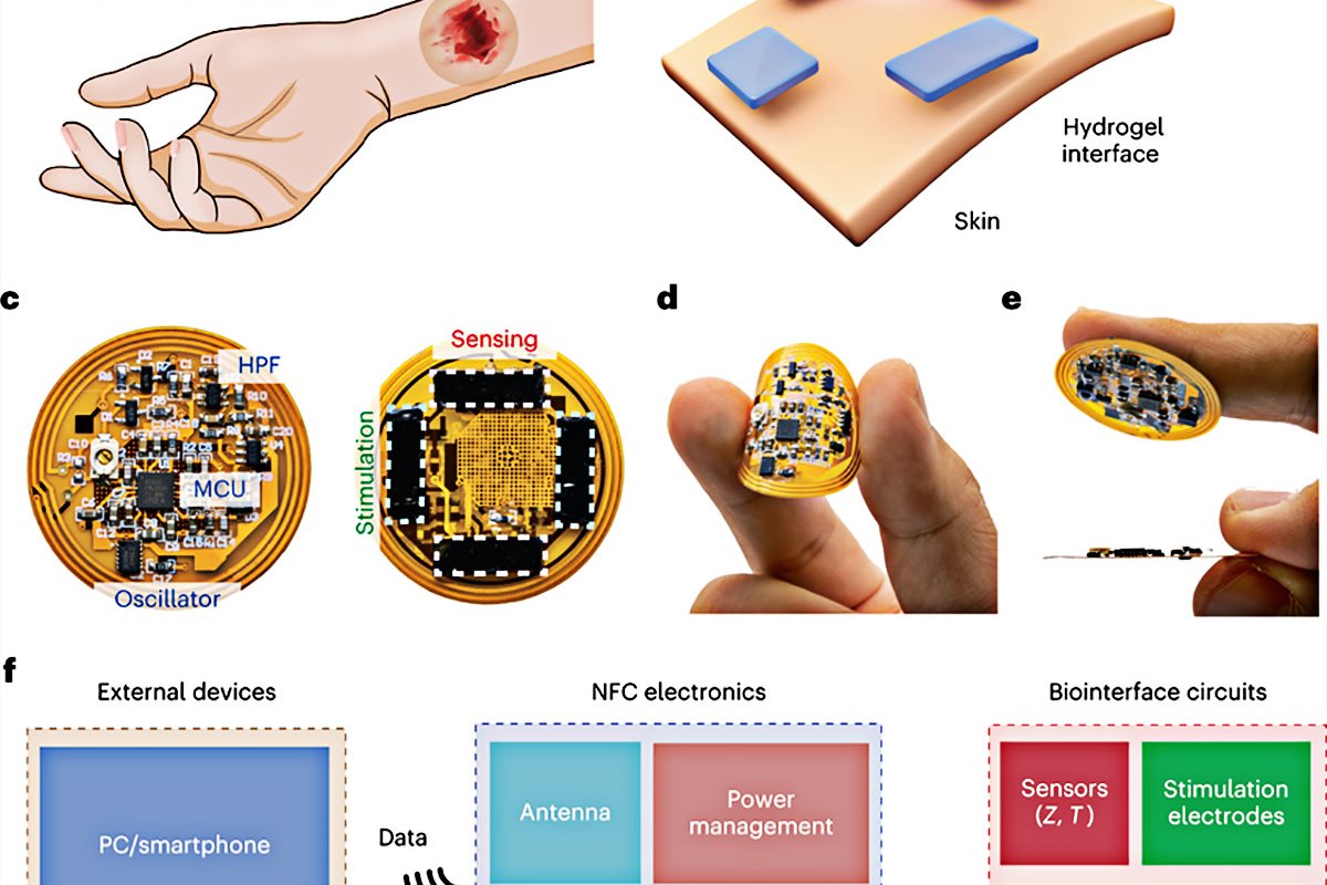 Curativo inteligente acelera a cicatrização de feridas crônicas