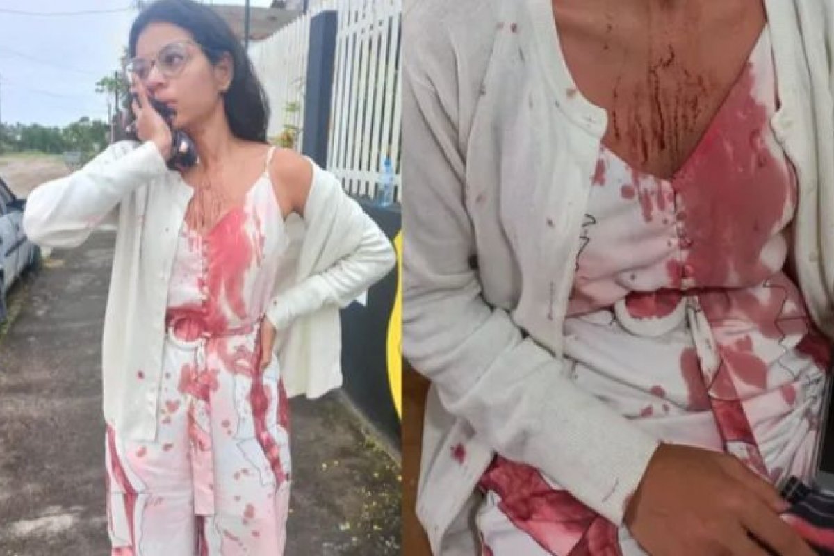 Jovem tem rosto cortado enquanto dormia em viagem de ônibus na Bahia