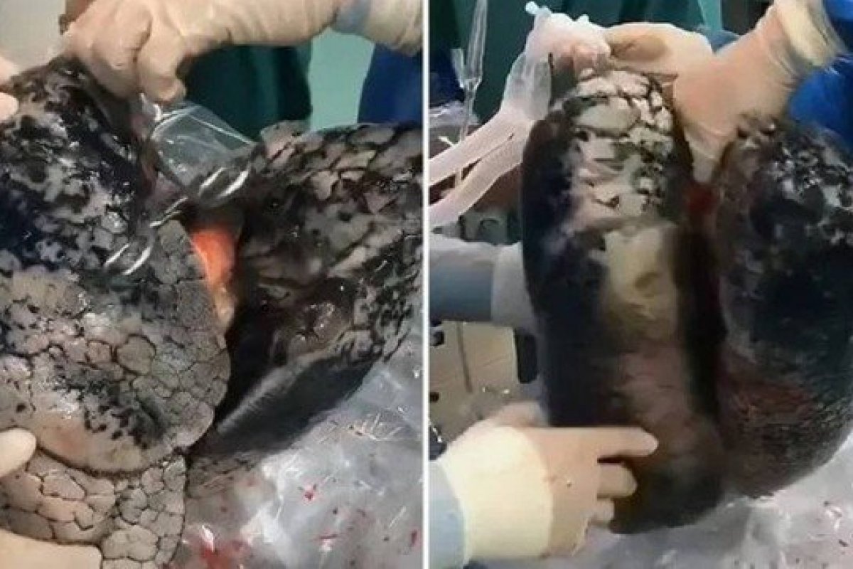 Tabagismo: imagens dos pulmões de fumante por 30 anos chocam a China 
