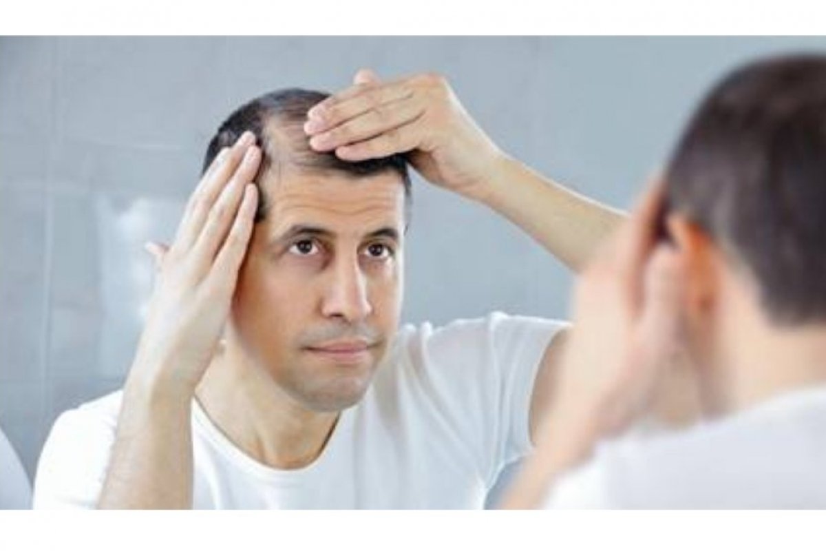 Xô queda capilar: Conheça os tratamentos capazes de combater este mal