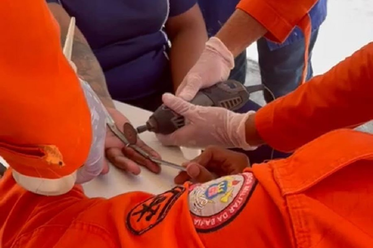 Vídeo: Bombeiros retiram dois anéis presos em dedo de uma mulher em Salvador