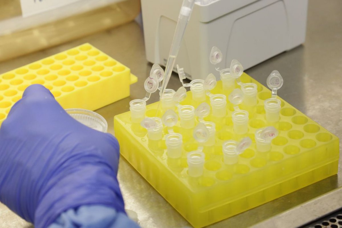 Coronavírus pode se espalhar para diversos tecidos do corpo humano, diz estudo