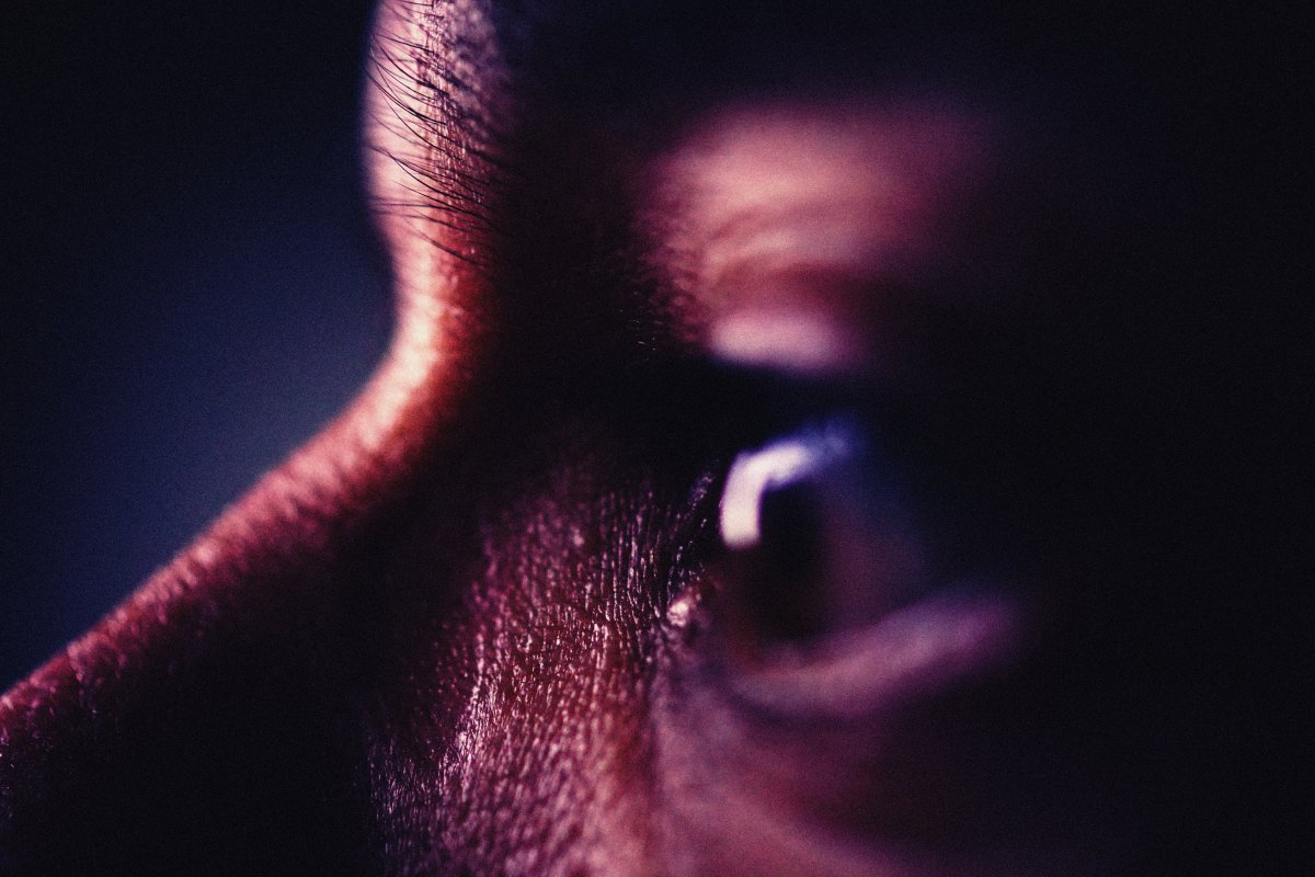 Substâncias químicas em pomadas modeladoras podem causar complicações oculares