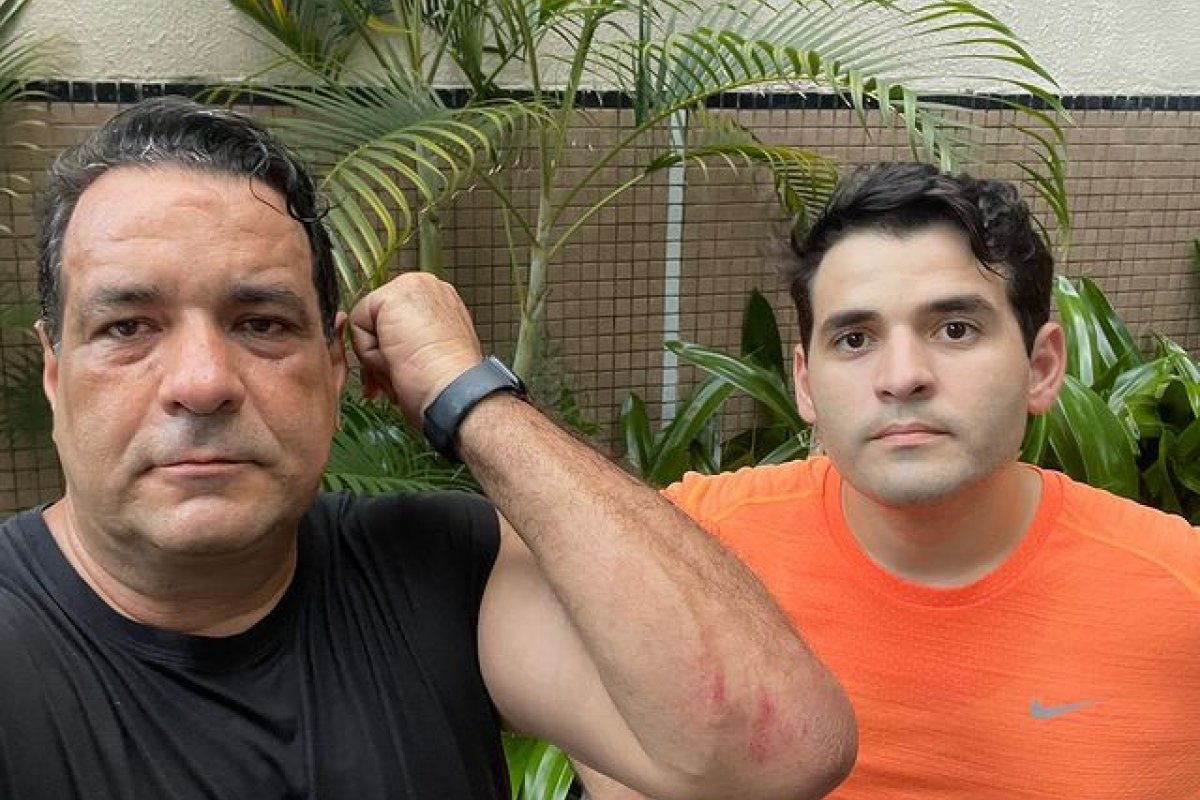 Deputado Alan Sanches é agredido após assalto na Barra