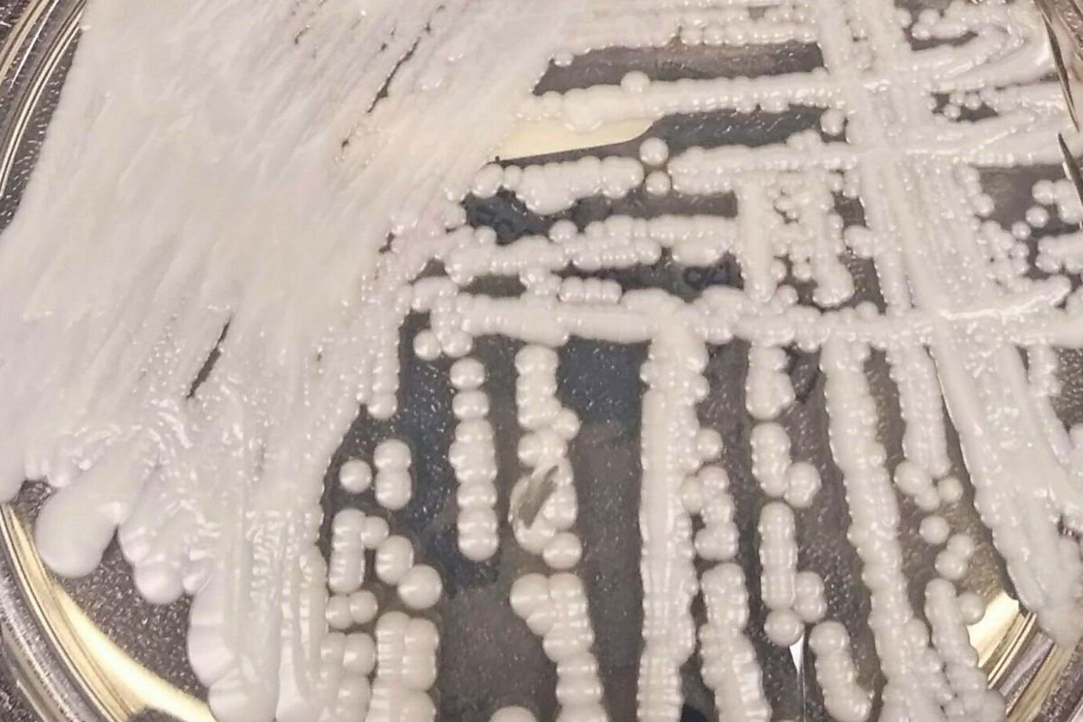 Cientistas registram maior surto do fungo Candida auris no Brasil