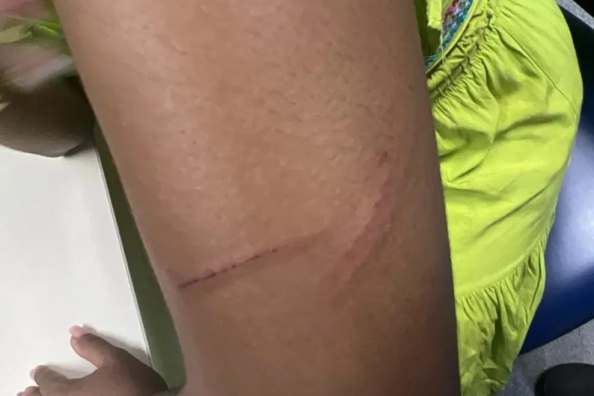 Defesa de motorista por aplicativo que agrediu passageira diz que houve violência 'mútua'