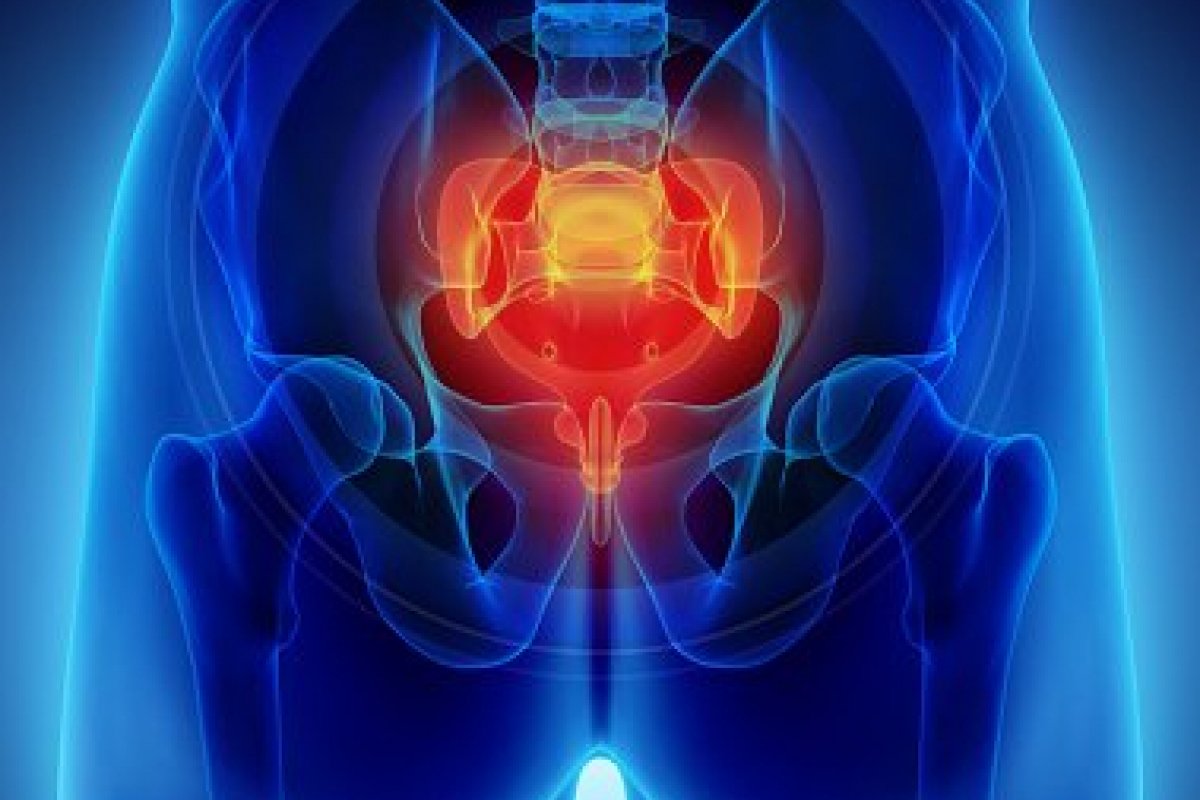 Cirurgia a laser é nova opção para tratar cisto pilonidal!