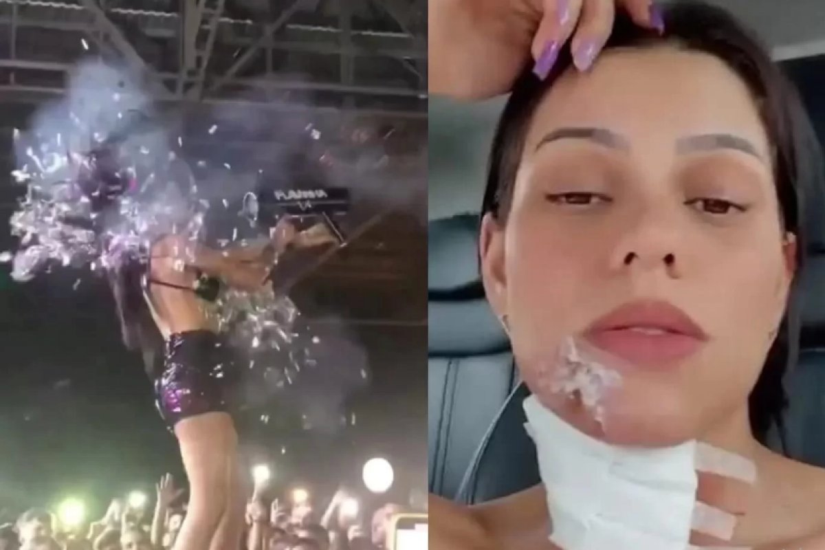 DJ que sofreu queimaduras no palco volta a fazer shows