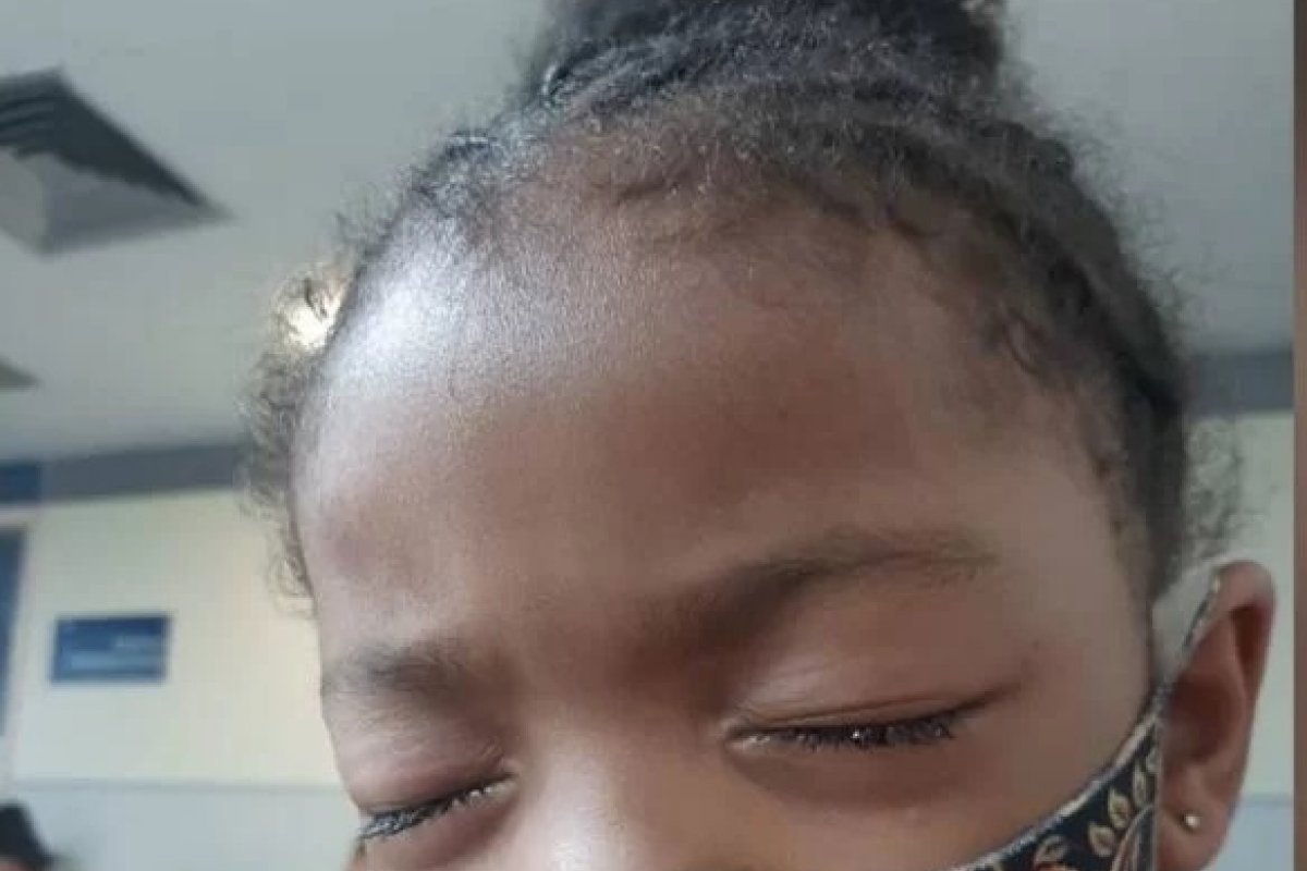 Conselho de Oftalmologia alerta para complicações causadas por pomadas modeladoras