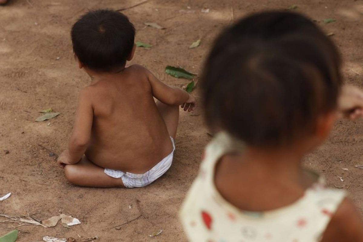 Desnutrição atinge cerca de 50% de crianças Yanomami de até 5 anos