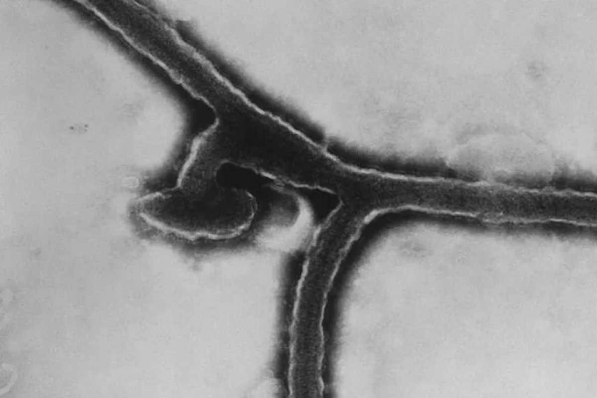 Marburg: conheça o vírus que é primo do ebola e possui alta taxa de mortalidade