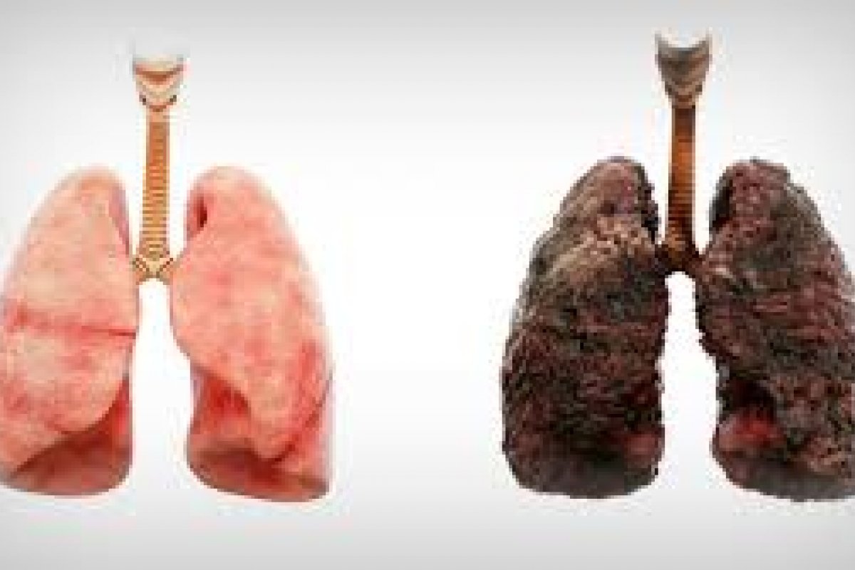 Entenda o que o cigarro faz no corpo