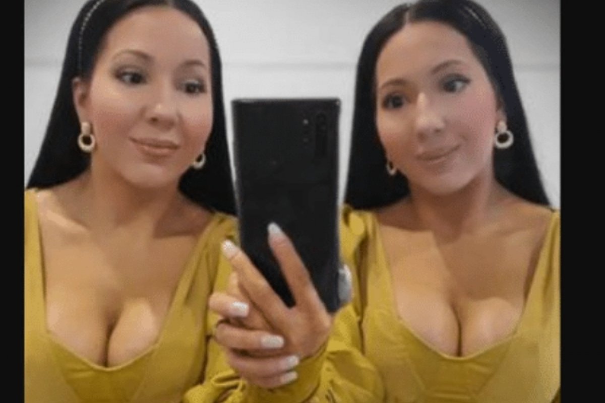 Gêmeas idênticas removem dentes para ficarem ainda mais parecidas