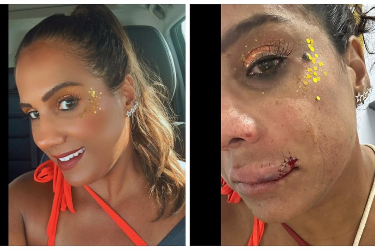 Carnaval: imagens gravadas mostra o momento em que mulher é agredida no Bloco da Quinta