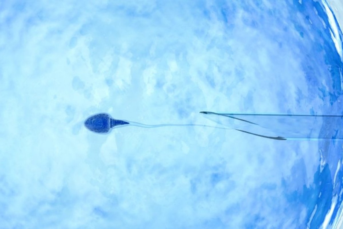 Reprodução assistida tem optado por transferência de um único embrião