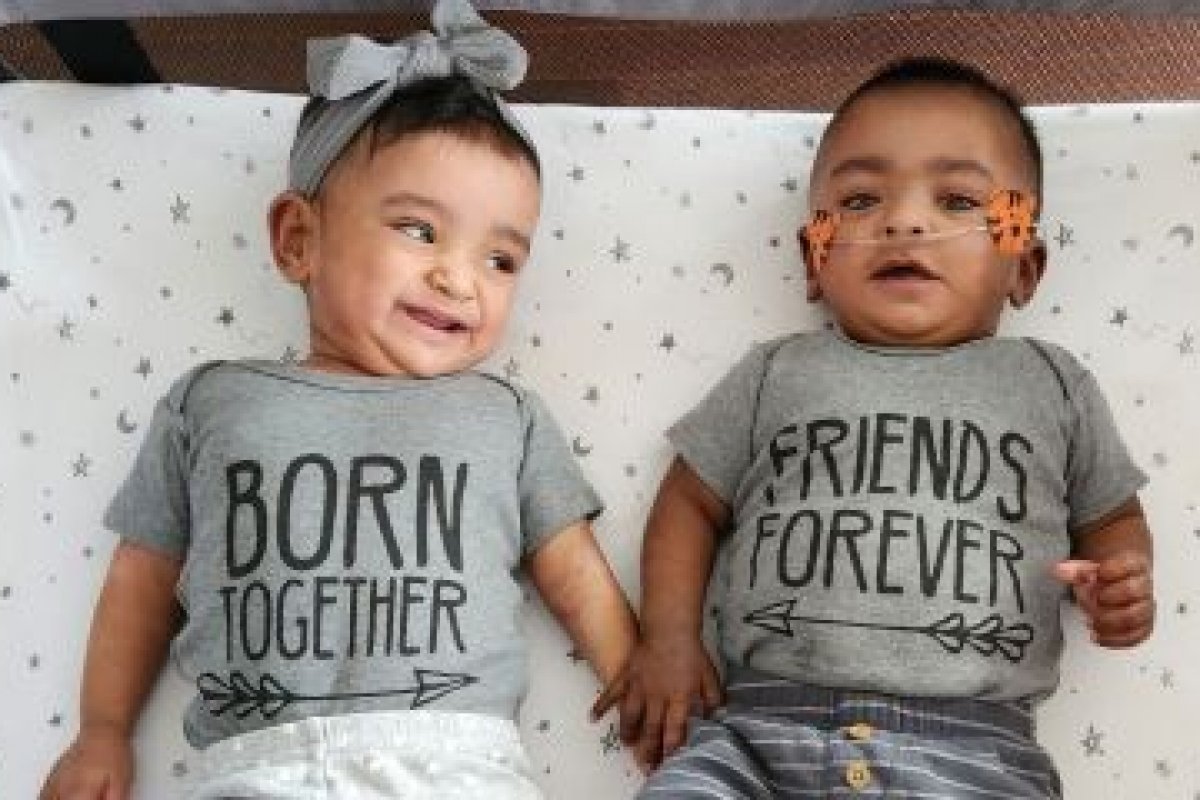 Irmãos nascem com 21 semanas e são considerados os gêmeos mais prematuros do mundo