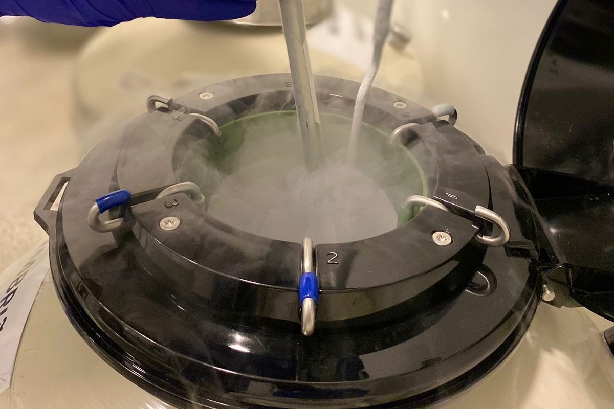 Congelamento de óvulos amplia perspectivas de maternidade da mulher moderna!