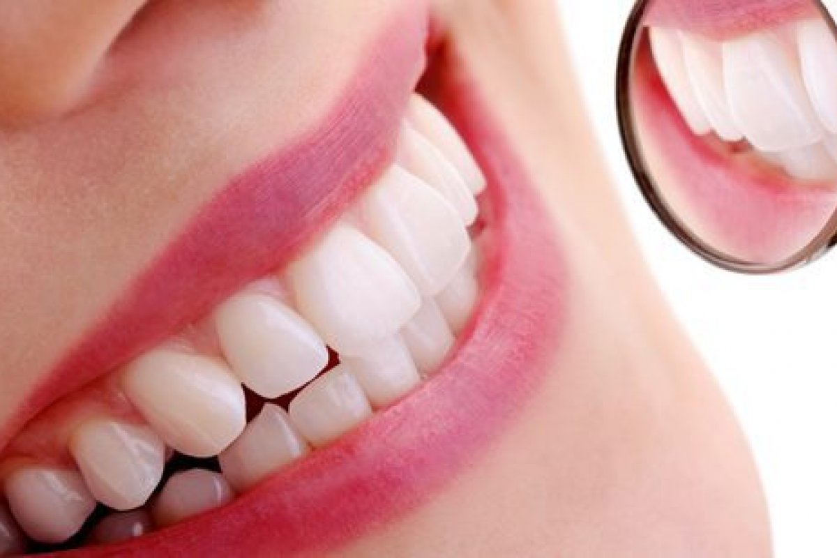 Sorriso dos famosos: saiba os benefícios da harmonização dental!