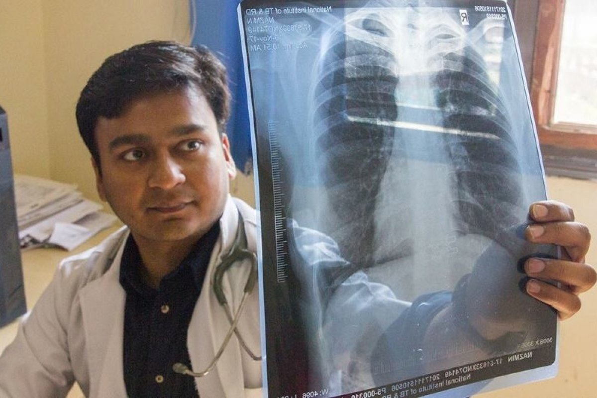 Cerca de 1,6 milhão de pessoas morreram por tuberculose no mundo, segundo ONU