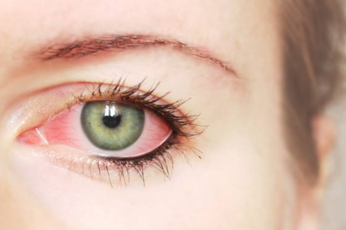 Diabetes e hipertensão aumentam risco de glaucoma, diz estudo!