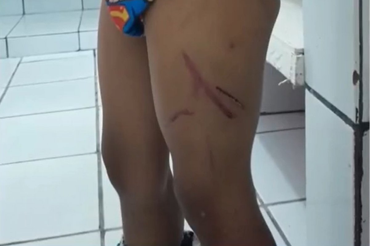 Pai é preso suspeito de maus tratos a criança de 4 anos no sul da Bahia