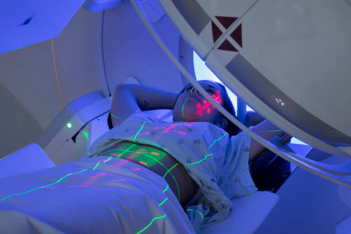 Relatório aponta que 73 mil pacientes ficam sem radioterapia por ano no SUS