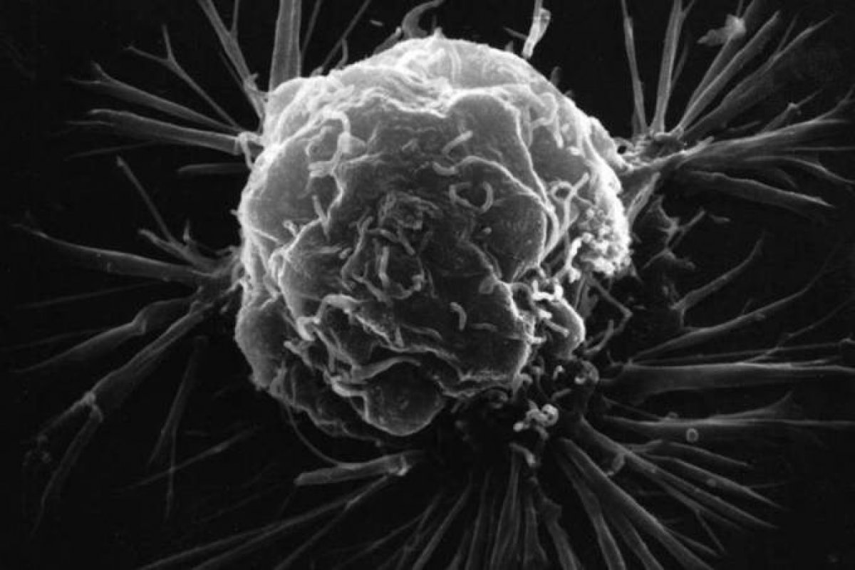 Tintas de cabelo e câncer de mama podem estar relacionadas, segundo pesquisa