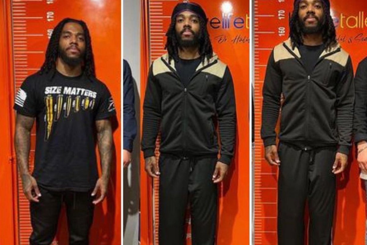 Homem 'cresce' 17 centímetros após passar por cirurgias nos EUA