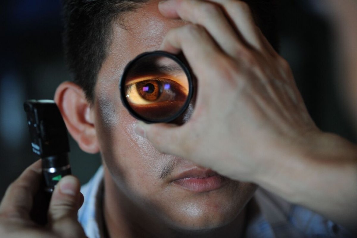 SUS: oftalmologistas salvam mais de 1,2 milhão do risco da cegueira pelo glaucoma