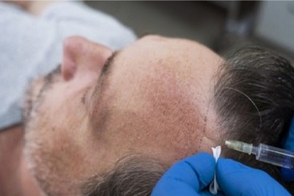 Investimentos em tratamentos capilares e procedimentos de fertilidade têm crescimento expressivo no Brasil