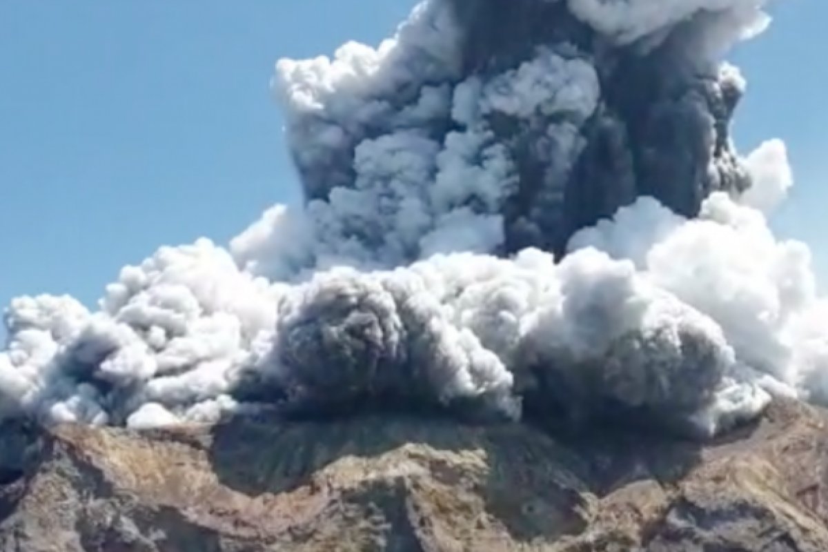 Nova Zelândia pede doações de pele para tratar vítimas de vulcão aos EUA