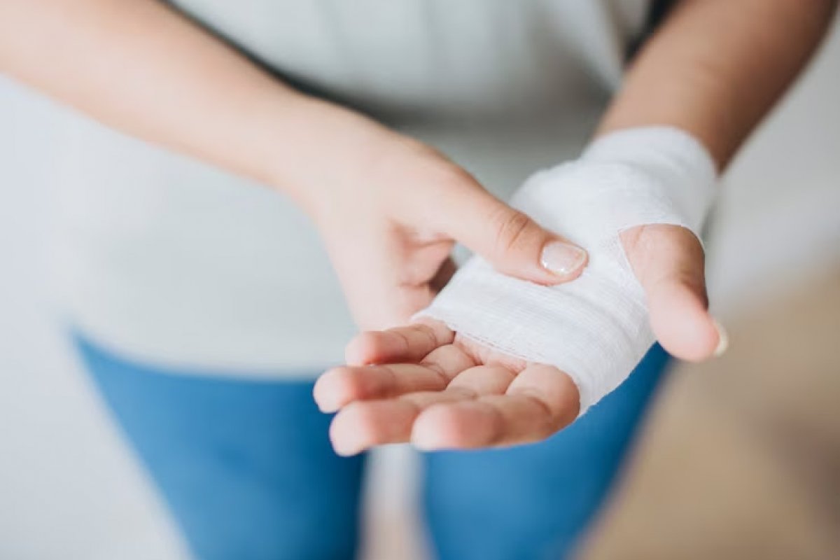 São João: especialistas alertam para riscos de receitas caseiras contra queimaduras