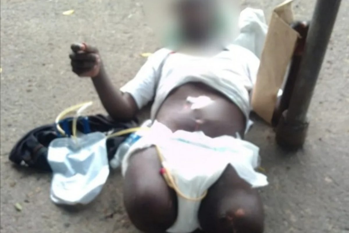 Funcionários de hospital abandonam homem sem perna na porta da unidade no Rio de Janeiro