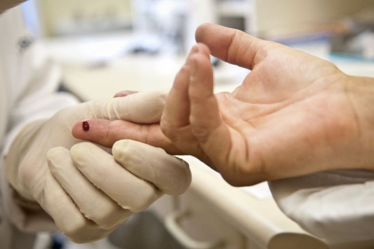 SUS passa a oferecer novos testes para diagnóstico de clamídia e gonorreia