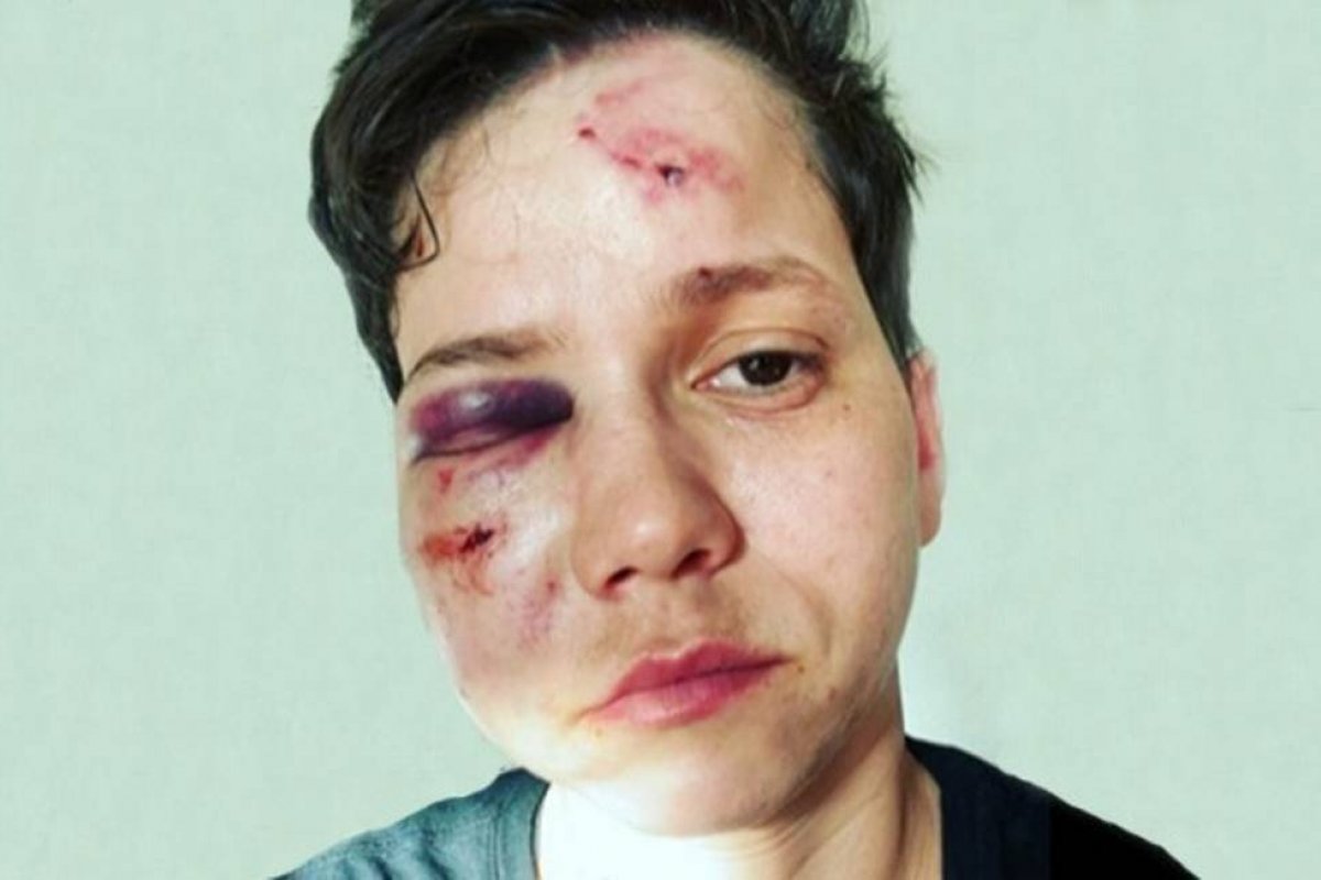 “Achei que ia morrer”, diz youtuber agredida no Rio