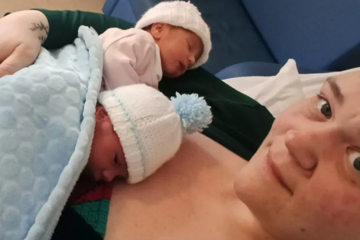 Em parto raro, mulher dá à luz a gêmeos nascidos exatamente ao mesmo tempo