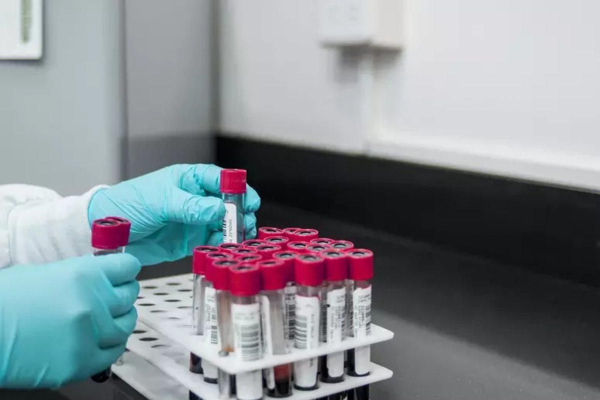 Check-up: entenda o que os exames de sangue revelam sobre a saúde