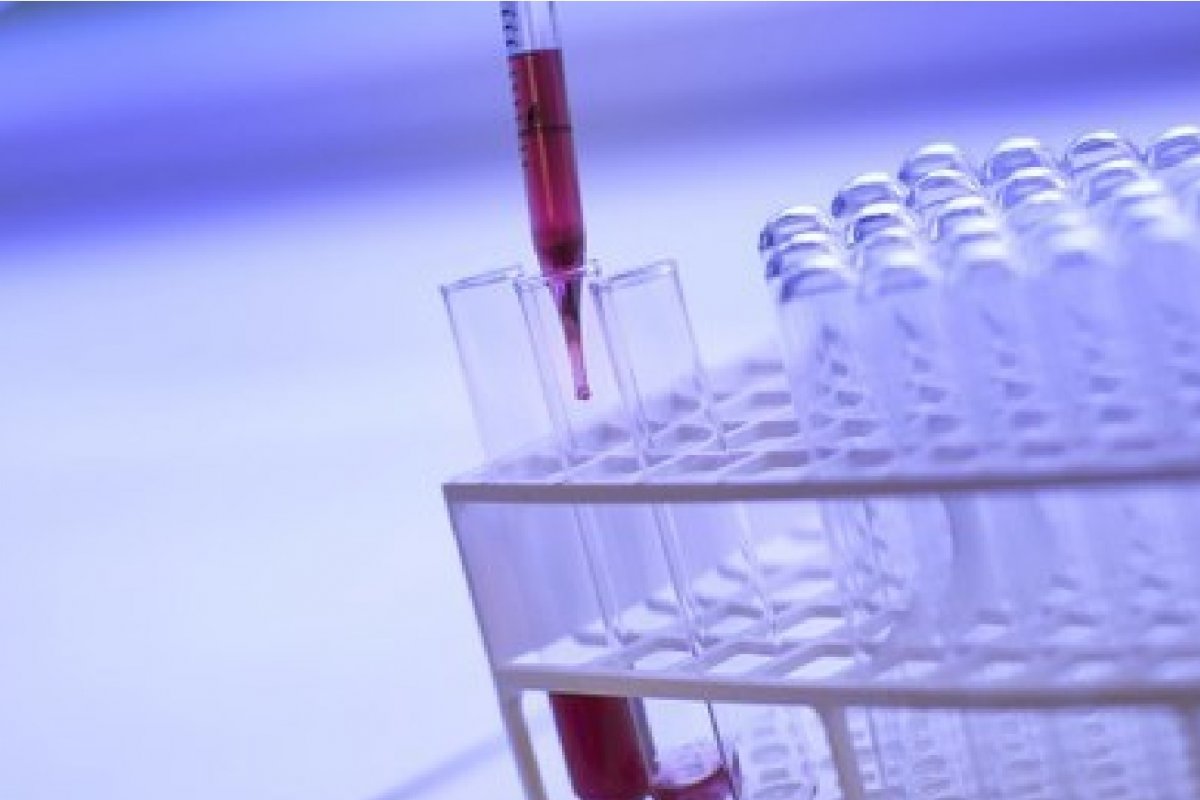 MPF e Ministério Público junto ao TCU questionam alterações na comercialização do plasma humano